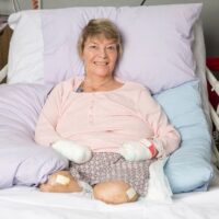 what is sepsis?